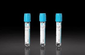 Sodium Citrate 3.2% blood collection tubes 13x75 mm with blue cap volume 3.6 ml pk of 100